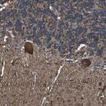 DHPS Antibody in Immunohistochemistry (IHC)