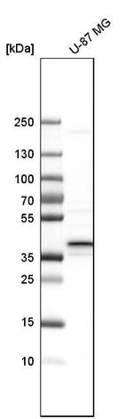 CALHM2 Antibody in Western Blot (WB)