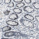 DDX47 Antibody in Immunohistochemistry (Paraffin) (IHC (P))