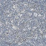 DDX47 Antibody in Immunohistochemistry (Paraffin) (IHC (P))