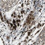 CTR2 Antibody in Immunohistochemistry (Paraffin) (IHC (P))