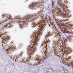 Aquaporin 3 Antibody in Immunohistochemistry (IHC)