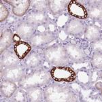 Aquaporin 3 Antibody in Immunohistochemistry (IHC)