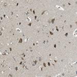 BRI3BP Antibody in Immunohistochemistry (Paraffin) (IHC (P))