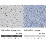 B4GALNT1 Antibody in Immunohistochemistry (IHC)