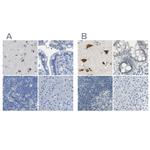 B4GALNT1 Antibody in Immunohistochemistry (IHC)