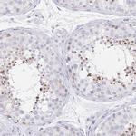 EQTN Antibody in Immunohistochemistry (IHC)