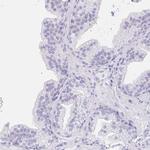 EQTN Antibody in Immunohistochemistry (IHC)