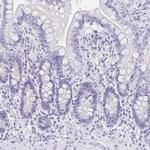 EQTN Antibody in Immunohistochemistry (IHC)