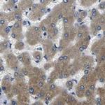 PLCE1 Antibody in Immunohistochemistry (IHC)