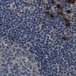 PLCE1 Antibody in Immunohistochemistry (IHC)