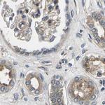 PLCE1 Antibody in Immunohistochemistry (IHC)