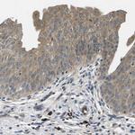 PLCE1 Antibody in Immunohistochemistry (IHC)