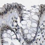 NSRP1 Antibody in Immunohistochemistry (IHC)