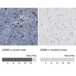 Granzyme M Antibody in Immunohistochemistry (IHC)