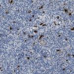 Granzyme M Antibody in Immunohistochemistry (IHC)