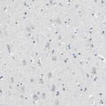 Granzyme M Antibody in Immunohistochemistry (IHC)