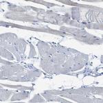 SLC10A6 Antibody in Immunohistochemistry (IHC)