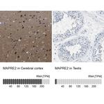 MAPRE2 Antibody in Immunohistochemistry (IHC)