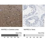 MAPRE2 Antibody