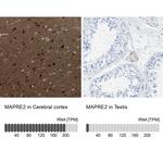 MAPRE2 Antibody in Immunohistochemistry (IHC)