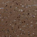 MAPRE2 Antibody in Immunohistochemistry (IHC)