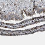 FAM62A Antibody in Immunohistochemistry (IHC)