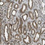 USP30 Antibody in Immunohistochemistry (IHC)