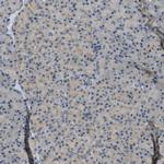 MAN2A2 Antibody in Immunohistochemistry (IHC)