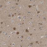 FIS1 Antibody in Immunohistochemistry (IHC)