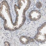 FIS1 Antibody in Immunohistochemistry (IHC)