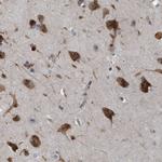 GPRASP2 Antibody in Immunohistochemistry (IHC)