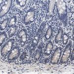 GPRASP2 Antibody in Immunohistochemistry (IHC)