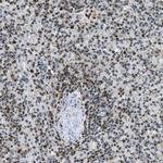 OGFR Antibody in Immunohistochemistry (IHC)