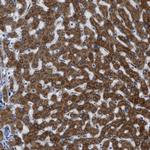 GGCX Antibody in Immunohistochemistry (Paraffin) (IHC (P))