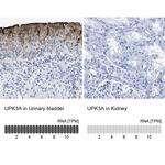 UPK3A Antibody in Immunohistochemistry (IHC)