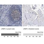 Lrmp Antibody in Immunohistochemistry (IHC)