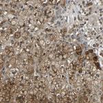 TCP-1 theta Antibody in Immunohistochemistry (IHC)