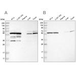 TCP-1 theta Antibody in Western Blot (WB)