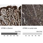 ATP8B1 Antibody in Immunohistochemistry (IHC)