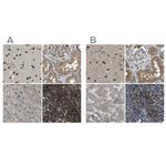 ATP8B1 Antibody in Immunohistochemistry (IHC)