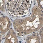 ATP8B1 Antibody in Immunohistochemistry (IHC)