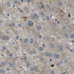 ATP8B1 Antibody in Immunohistochemistry (IHC)