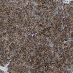 SLC43A1 Antibody in Immunohistochemistry (IHC)