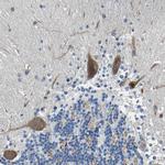 LIAS Antibody in Immunohistochemistry (Paraffin) (IHC (P))