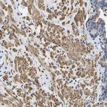 LIAS Antibody in Immunohistochemistry (Paraffin) (IHC (P))