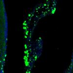 LIAS Antibody in Immunohistochemistry (Paraffin) (IHC (P))