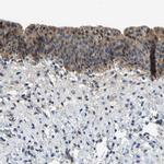 LIAS Antibody in Immunohistochemistry (Paraffin) (IHC (P))