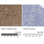 CRYM Antibody in Immunohistochemistry (IHC)