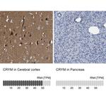 CRYM Antibody